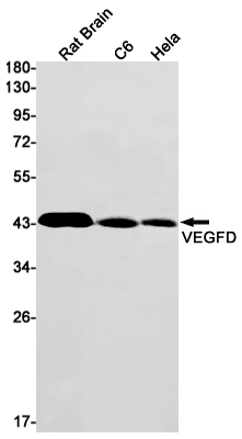 VEGFD Rabbit mAb ABZ3225