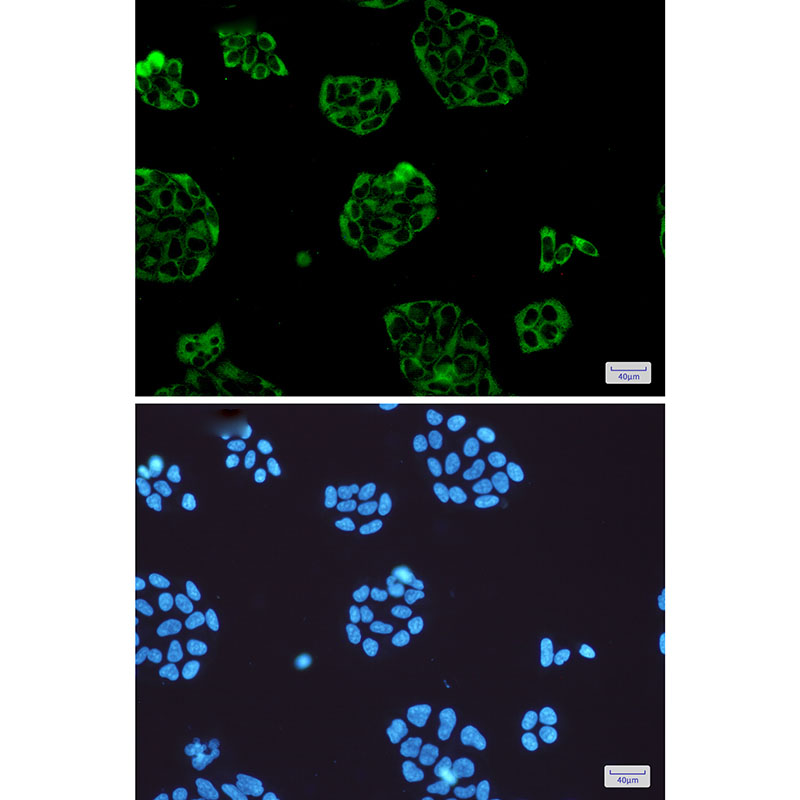 Vinculin Rabbit mAb ABZ3228