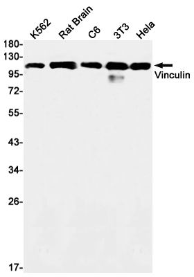 Vinculin Rabbit mAb ABZ3228
