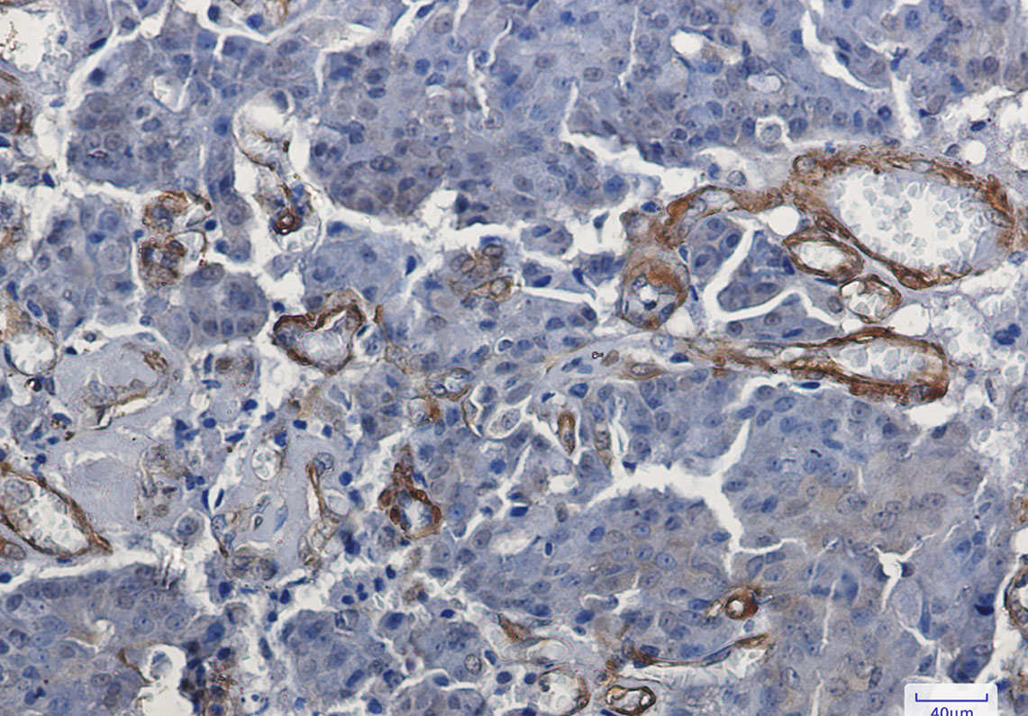Vinculin Rabbit mAb ABZ3229