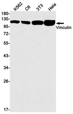 Vinculin Rabbit mAb ABZ3229