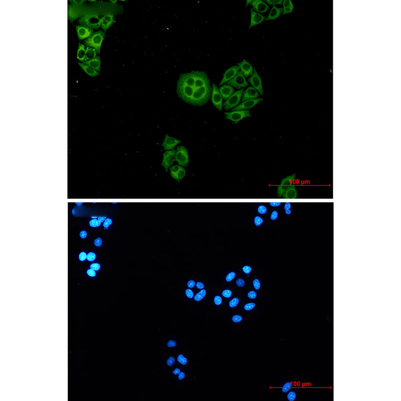 WDR1 Rabbit mAb ABZ3230