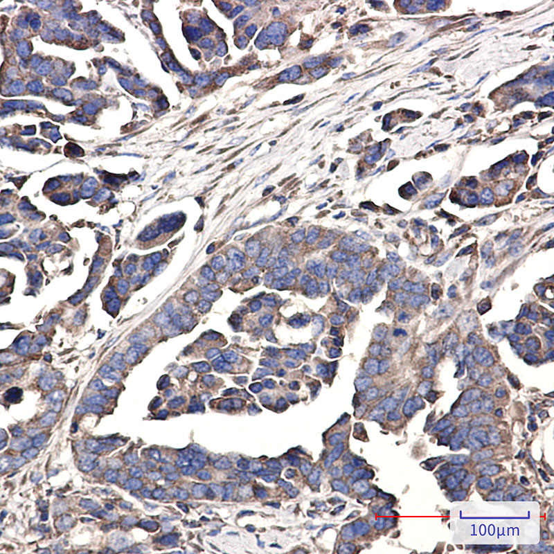 WDR1 Rabbit mAb ABZ3230