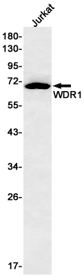 WDR1 Rabbit mAb ABZ3230
