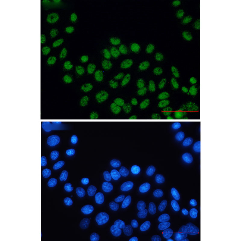 XPD Rabbit mAb ABZ3231
