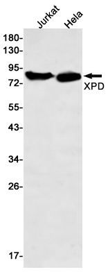 XPD Rabbit mAb ABZ3231