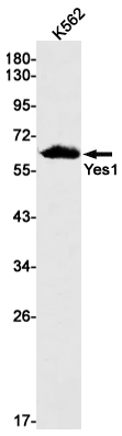 Yes1 Rabbit mAb ABZ3232