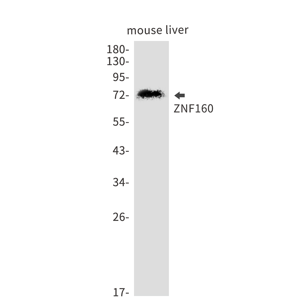 ZNF160 Rabbit mAb ABZ3233