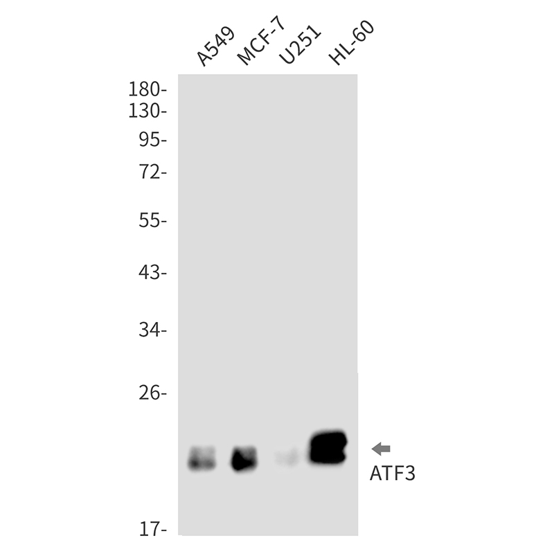 ATF3 Rabbit mAb ABZ3235