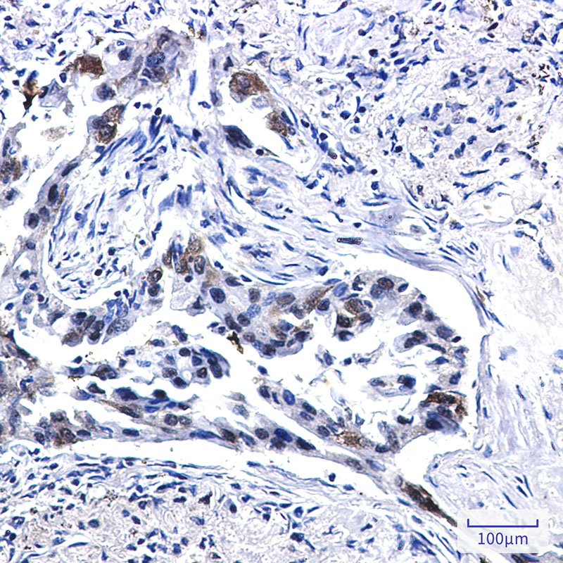 Tissue Factor Rabbit mAb ABZ3237