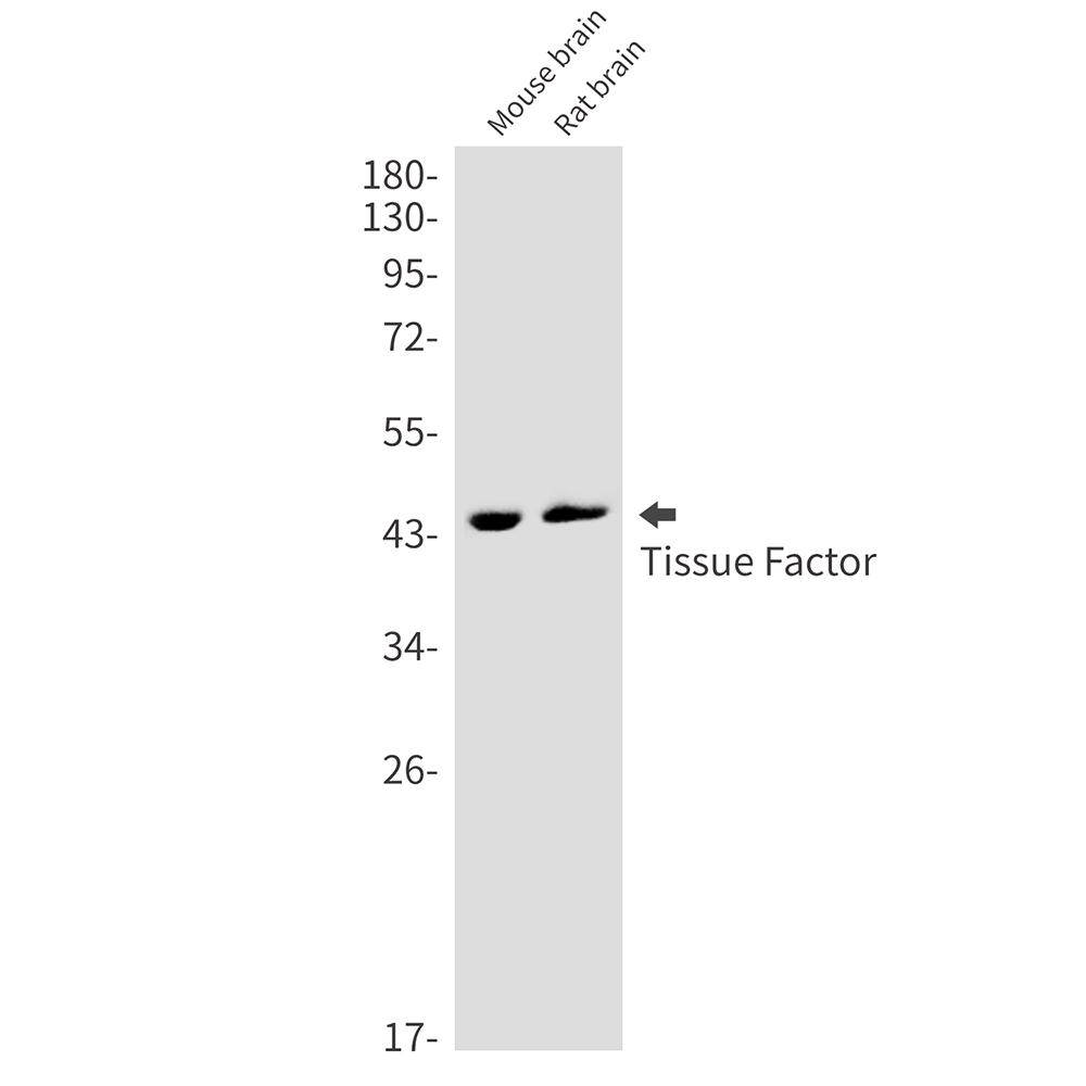 Tissue Factor Rabbit mAb ABZ3237