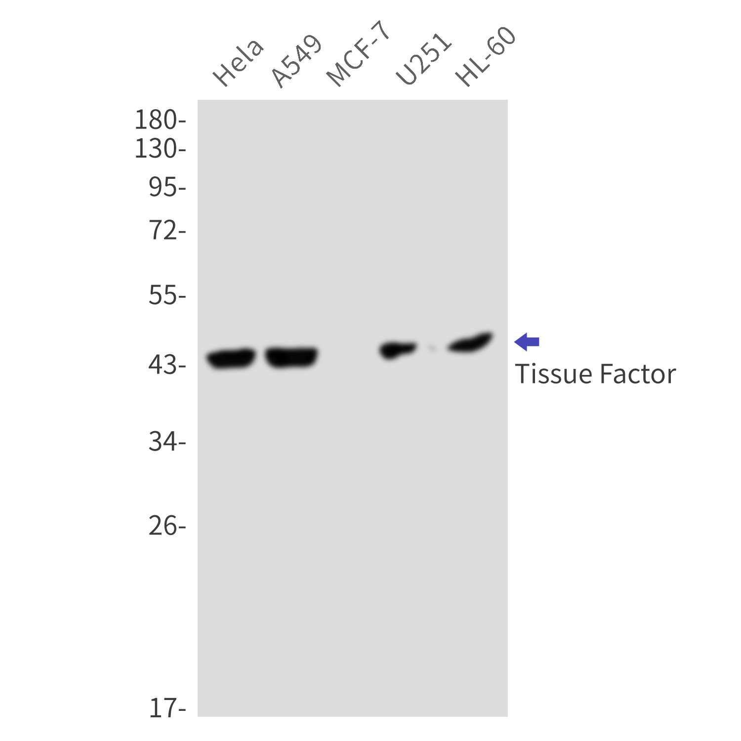 Tissue Factor Rabbit mAb ABZ3237