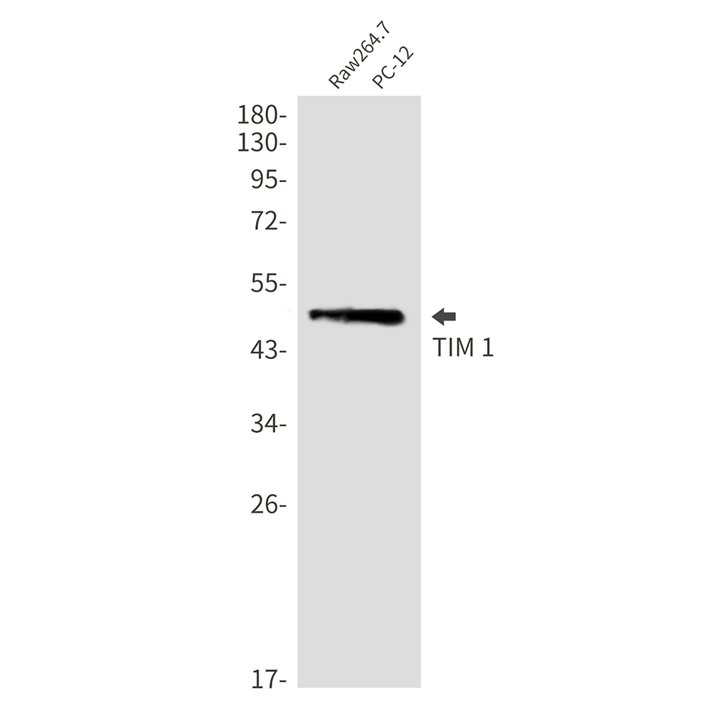 TIM 1 Rabbit mAb ABZ3238