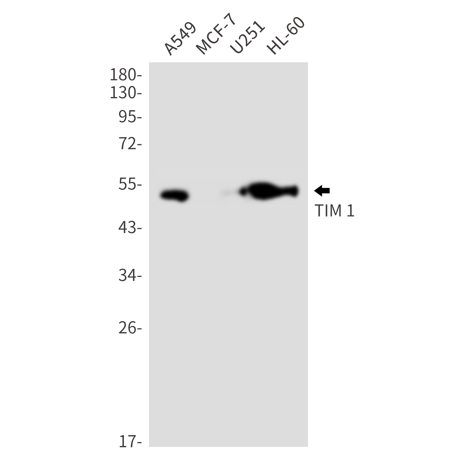 TIM 1 Rabbit mAb ABZ3238