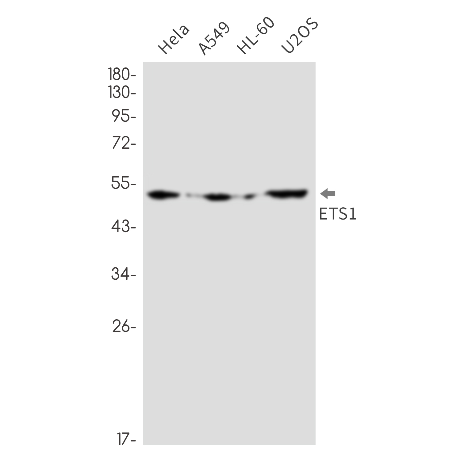 ETS1 Rabbit mAb ABZ3241