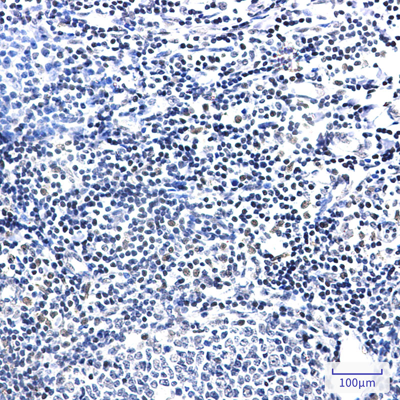 PIM1 Rabbit mAb ABZ3242