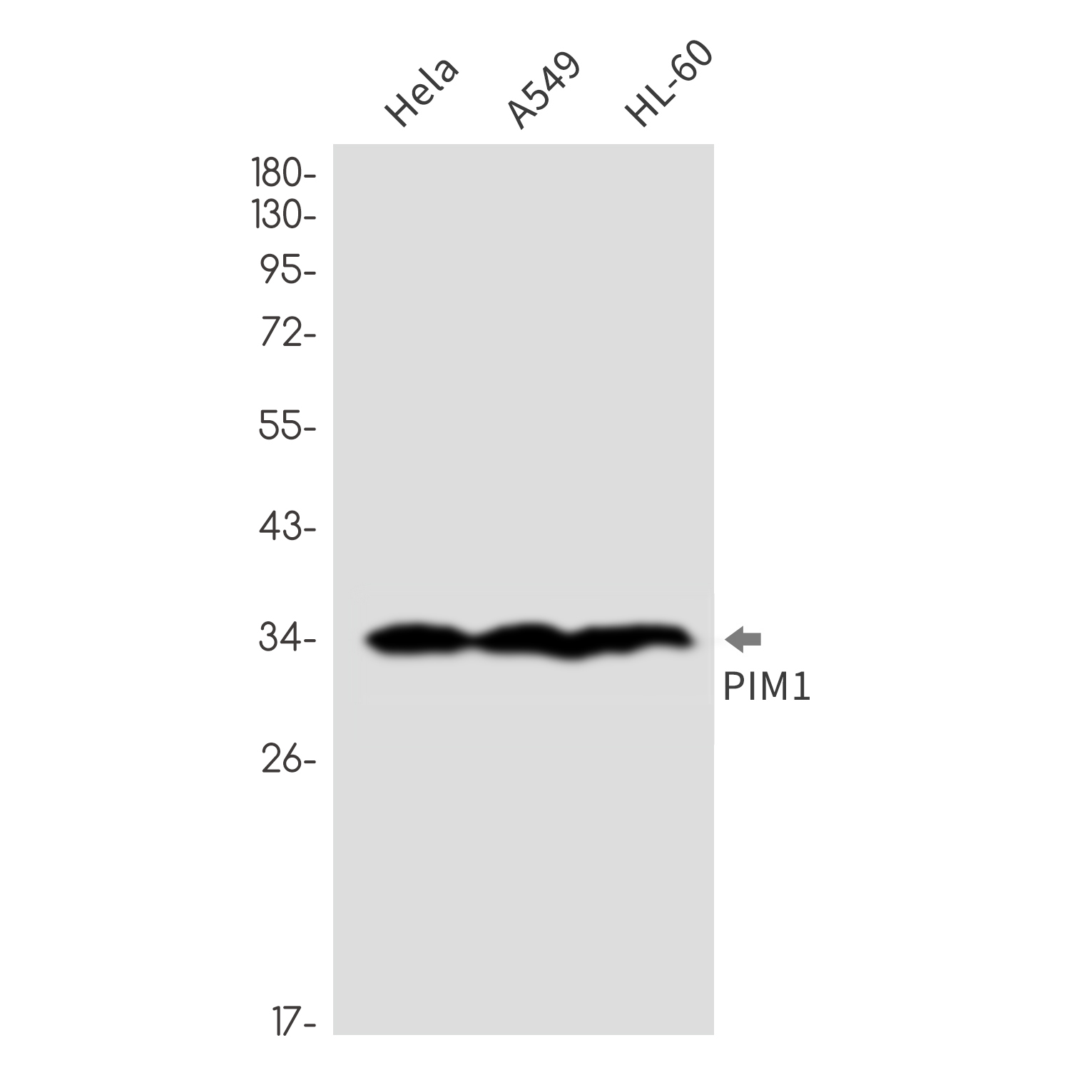 PIM1 Rabbit mAb ABZ3242