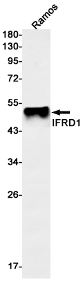 IFRD1 Rabbit mAb ABZ3243