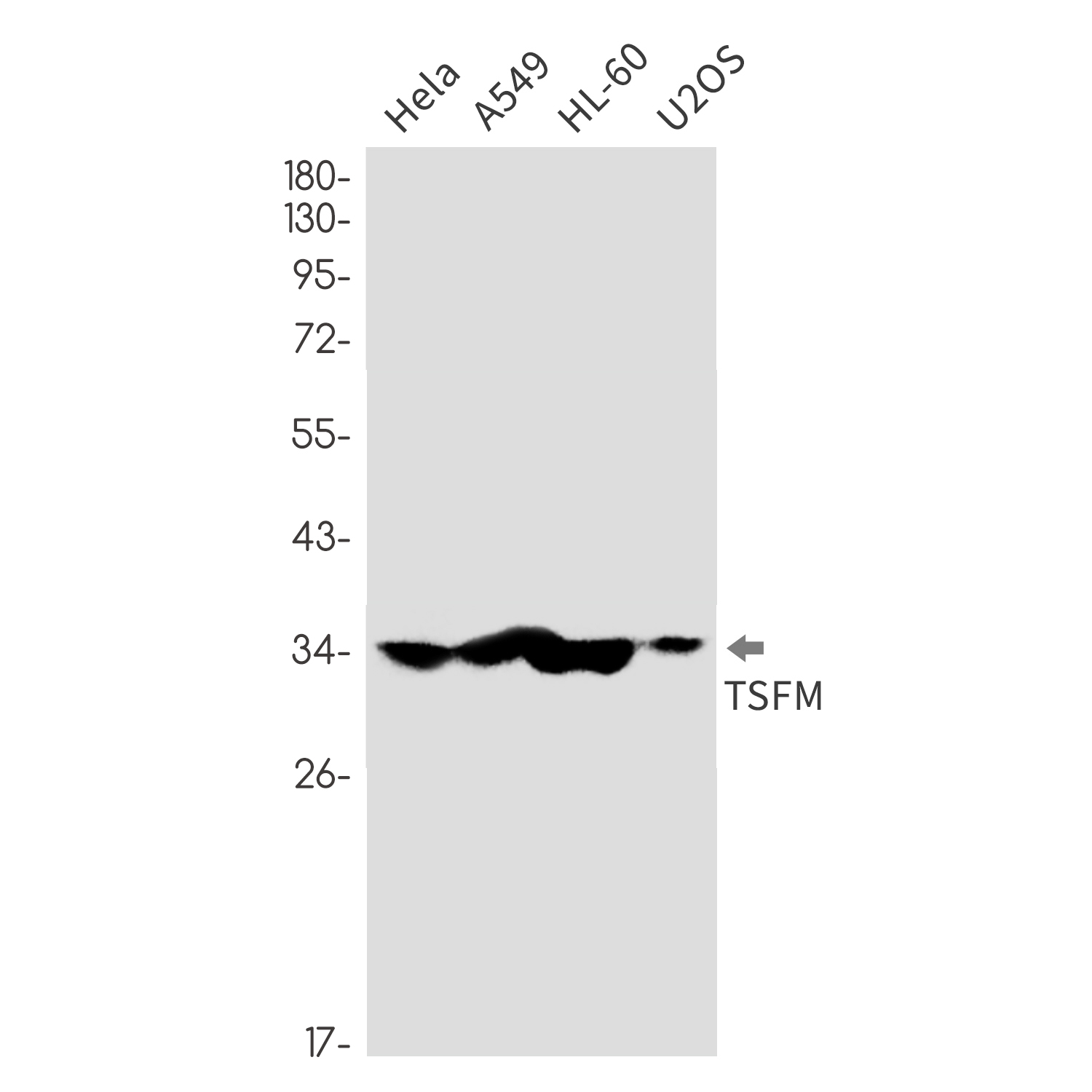 Elongation Factor Ts Rabbit mAb ABZ3244