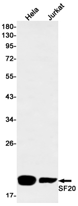 SF20 Rabbit mAb ABZ3245