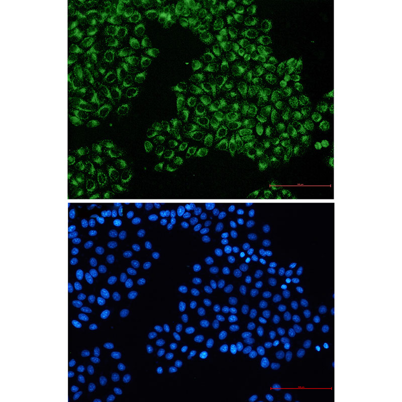 FGFR3 Rabbit mAb ABZ3246