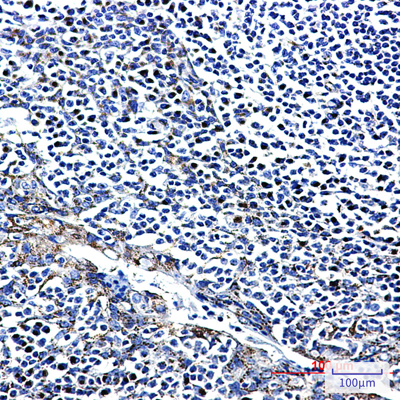 FGFR3 Rabbit mAb ABZ3246