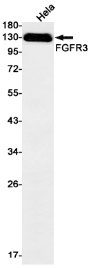 FGFR3 Rabbit mAb ABZ3246