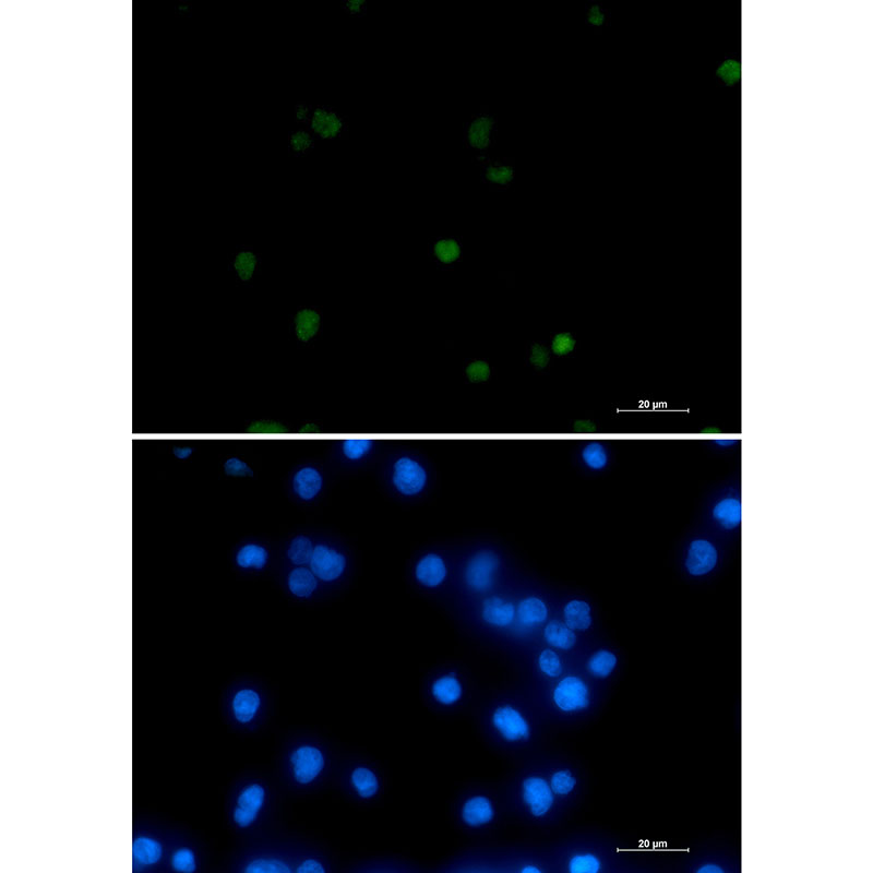 POLR2A Rabbit mAb ABZ3247
