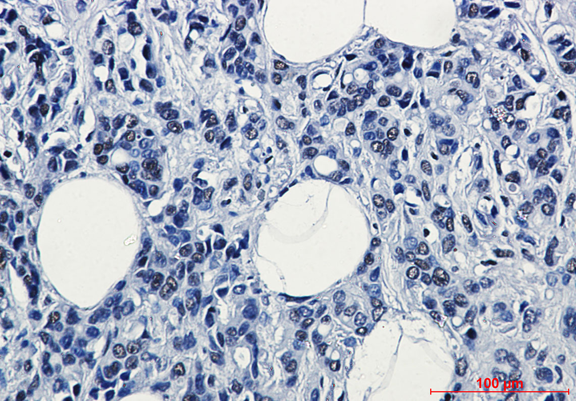 POLR2A Rabbit mAb ABZ3247