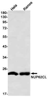 NUP62CL Rabbit mAb ABZ3248