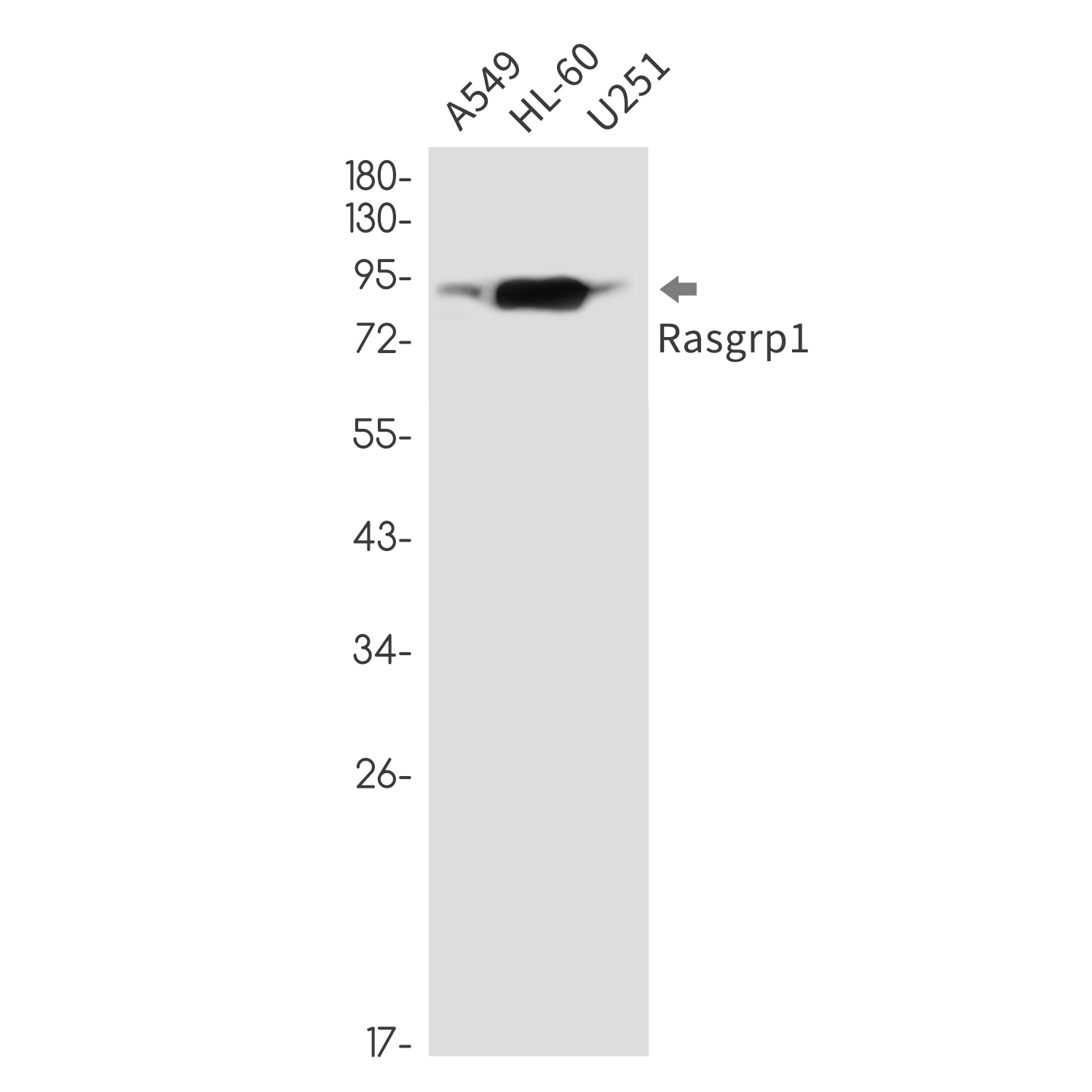 RASGRP1 Rabbit mAb ABZ3249