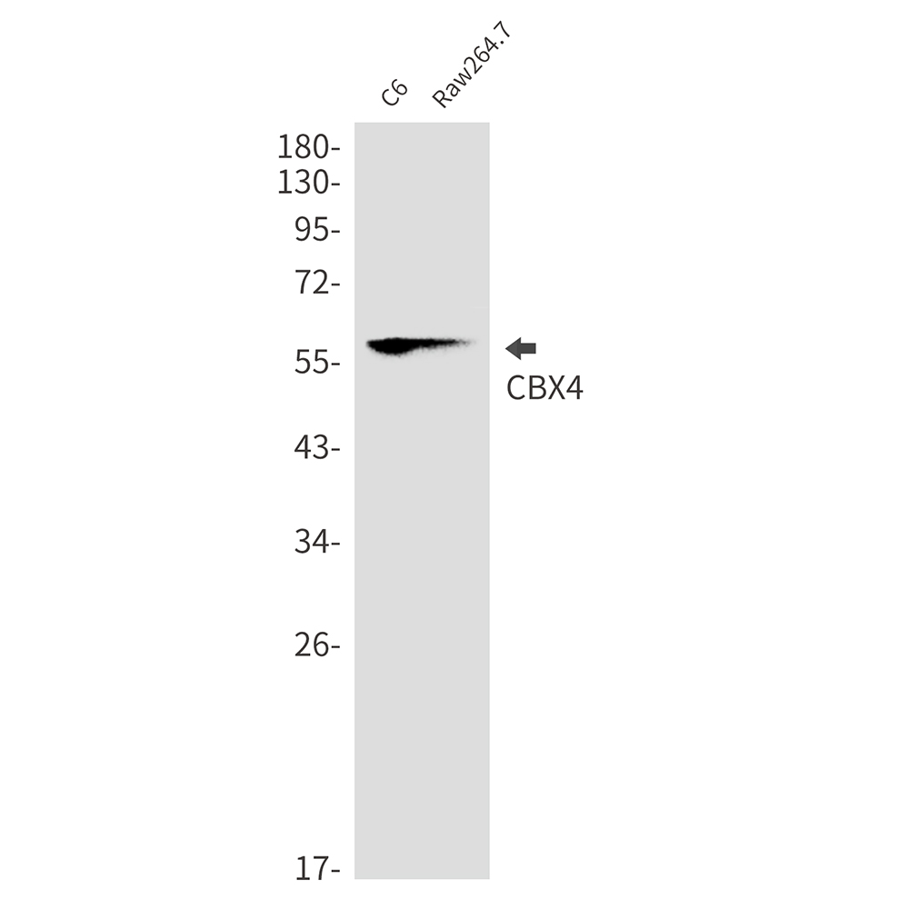 CBX4 Rabbit mAb ABZ3250