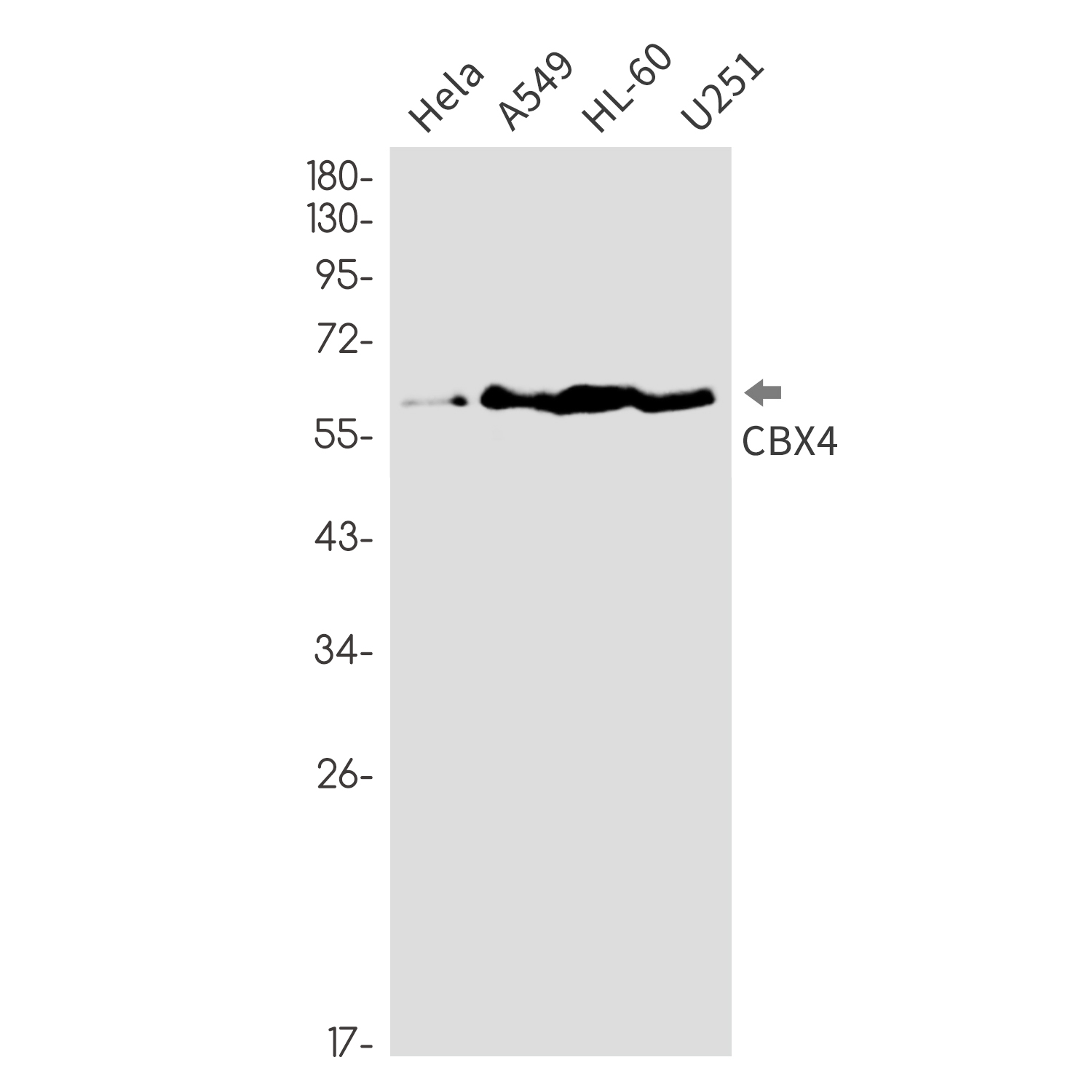 CBX4 Rabbit mAb ABZ3250