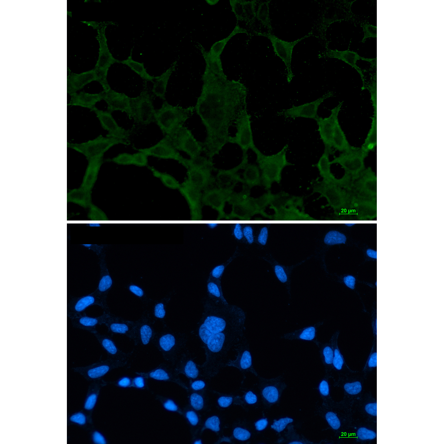 ACADM/MCAD Rabbit mAb ABZ3253
