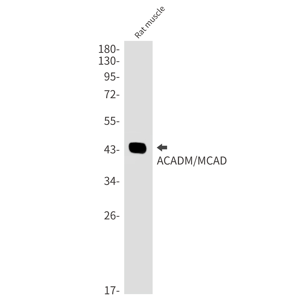 ACADM/MCAD Rabbit mAb ABZ3253