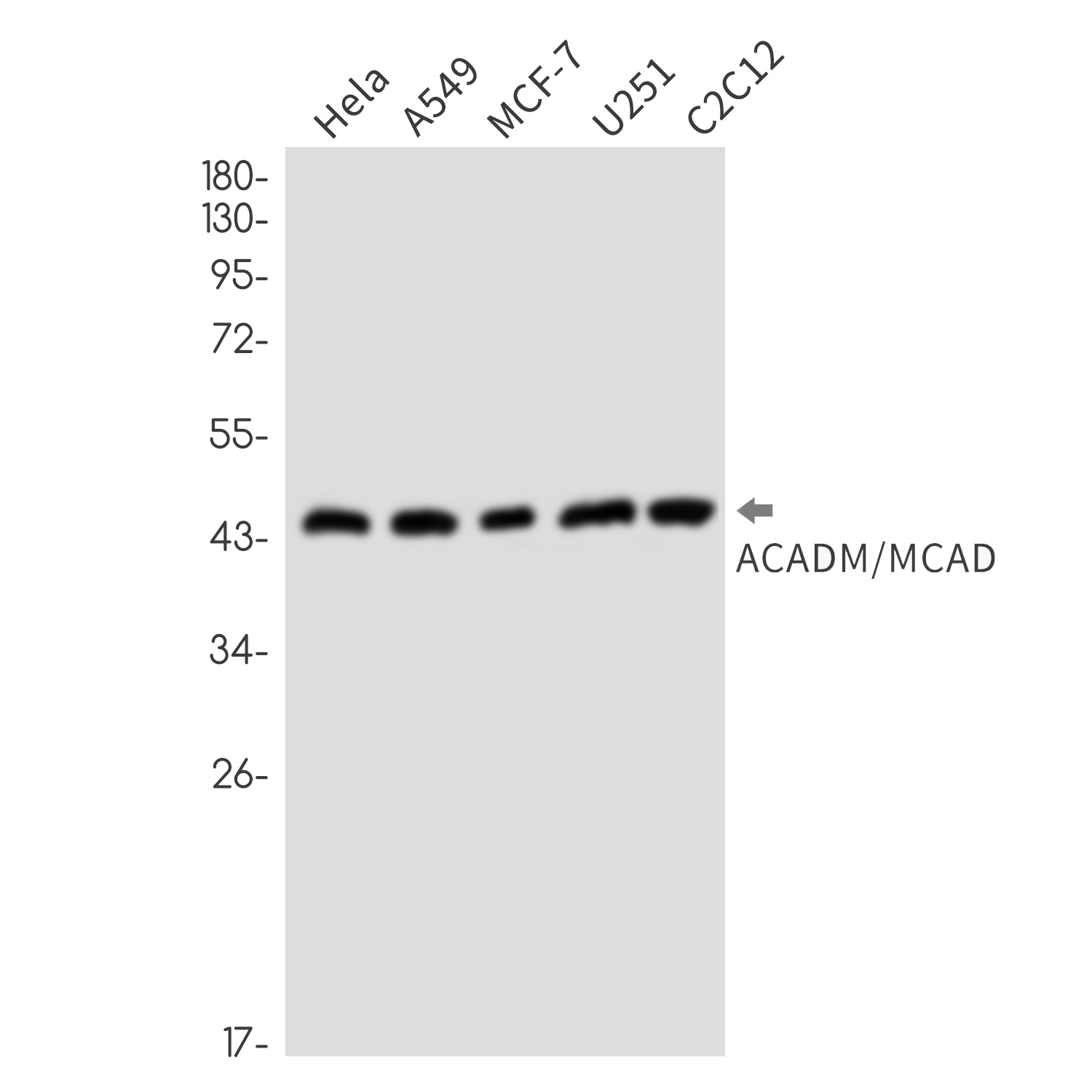 ACADM/MCAD Rabbit mAb ABZ3253