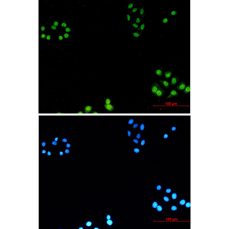 AKAP95 Rabbit mAb ABZ3255