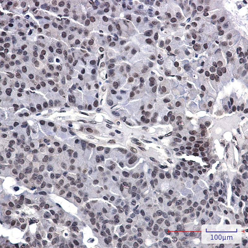 AKAP95 Rabbit mAb ABZ3255