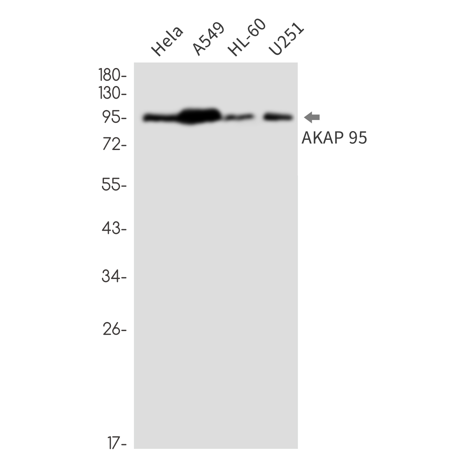 AKAP95 Rabbit mAb ABZ3255