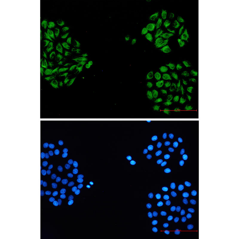 alpha Internexin Rabbit mAb ABZ3256