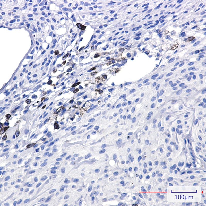 alpha Internexin Rabbit mAb ABZ3256