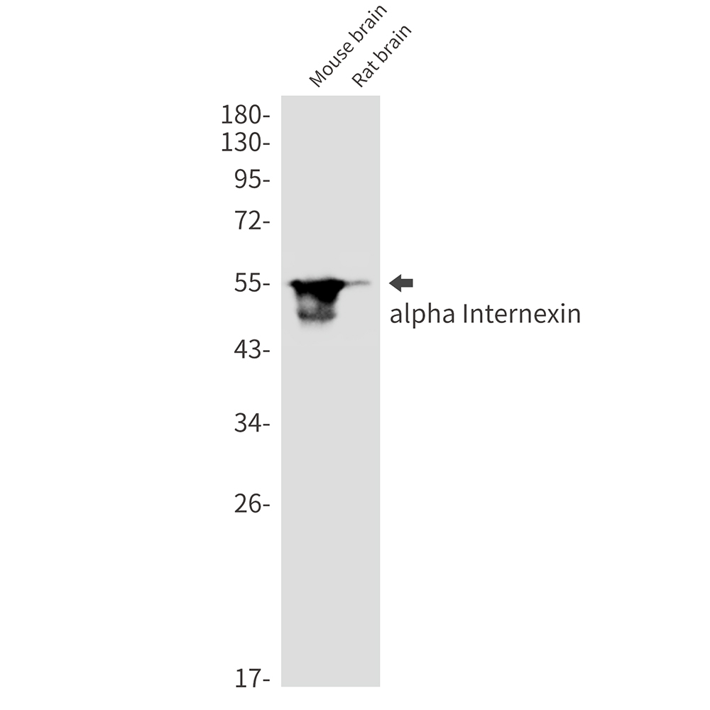 alpha Internexin Rabbit mAb ABZ3256