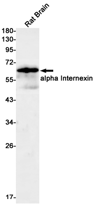 alpha Internexin Rabbit mAb ABZ3256