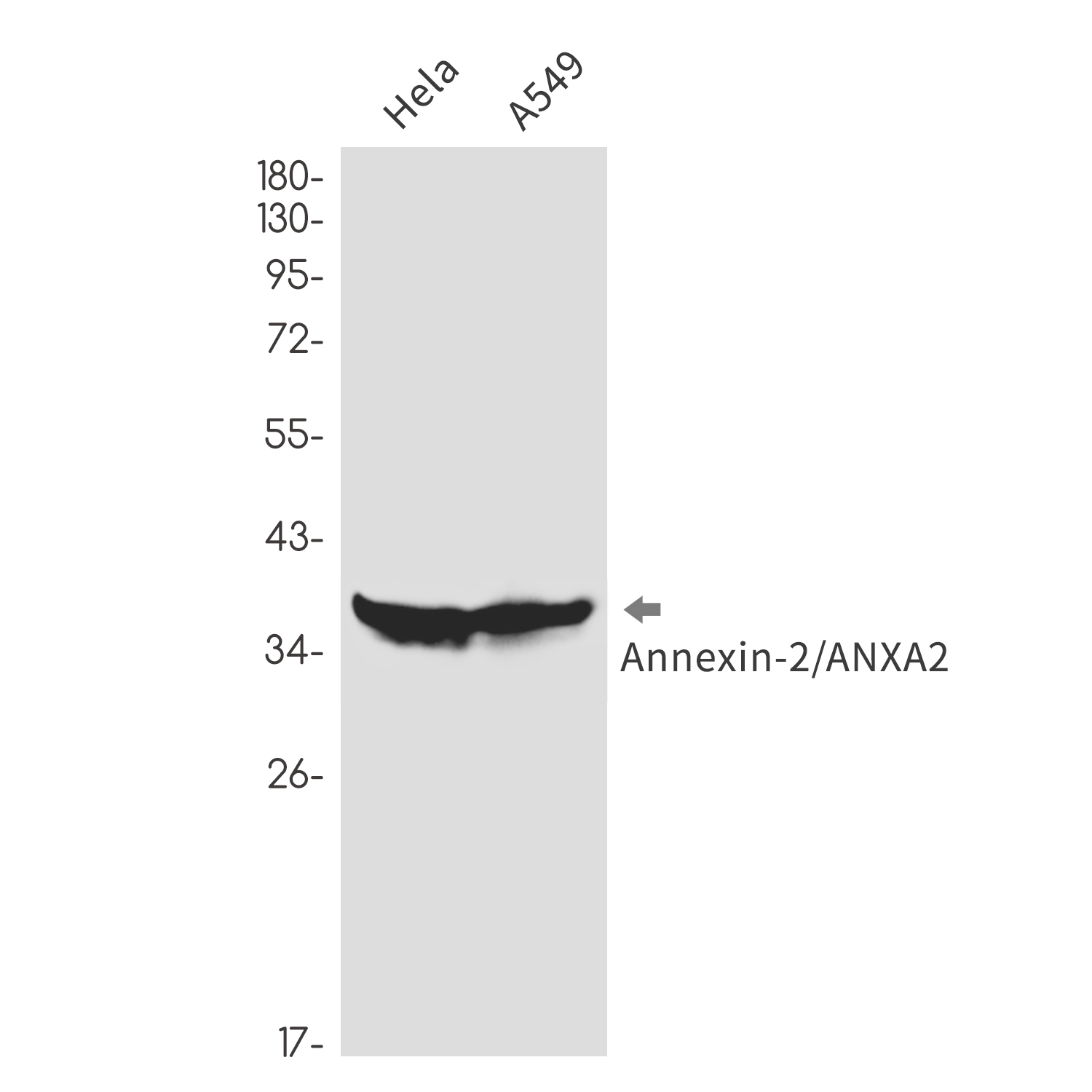 Annexin 2 Rabbit mAb ABZ3258