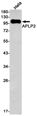 APLP2 Rabbit mAb ABZ3259
