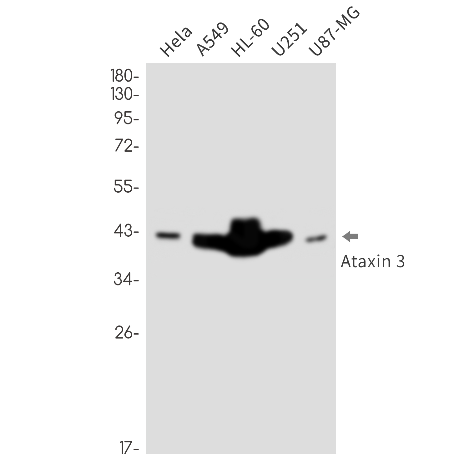 Ataxin 3 Rabbit mAb ABZ3260