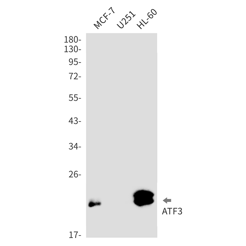 ATF3 Rabbit mAb ABZ3261