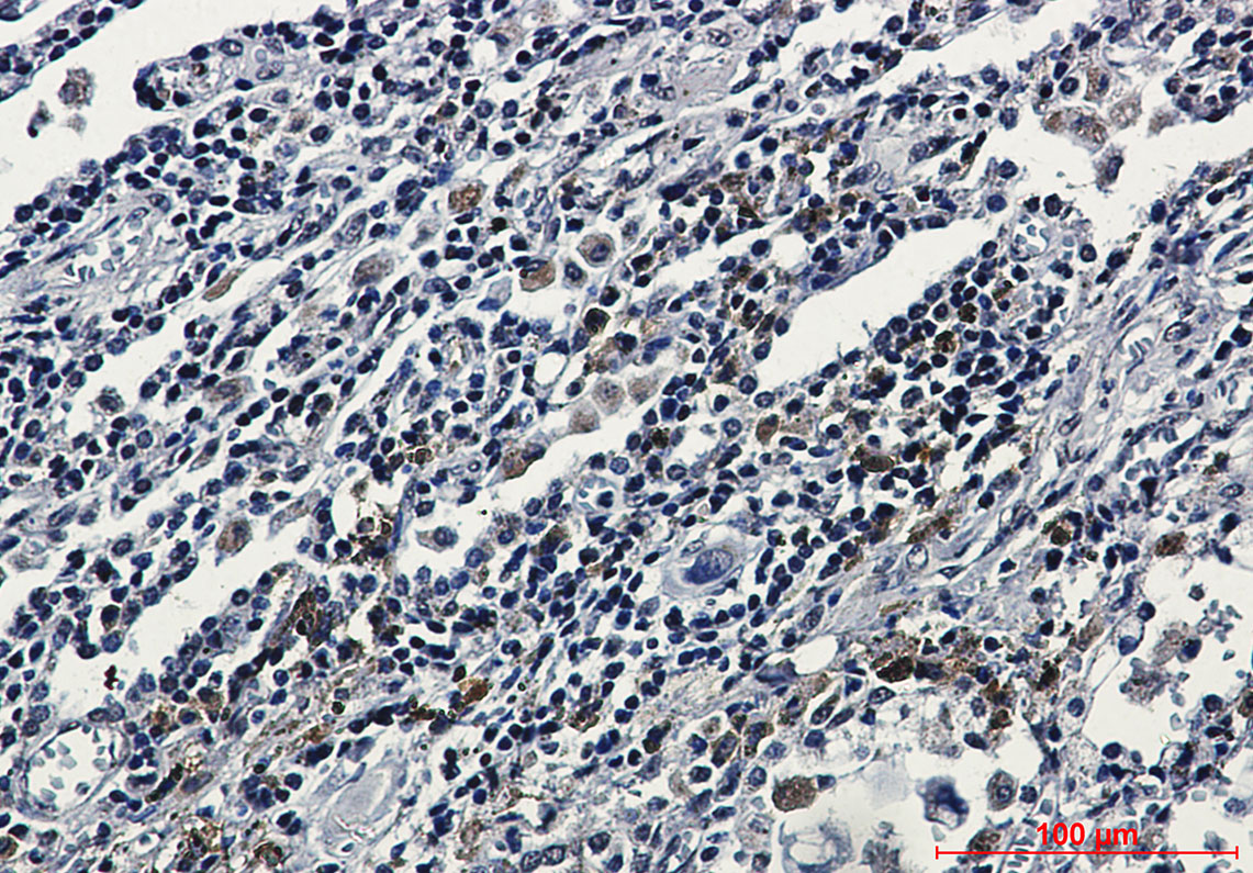 ATF6 Rabbit mAb ABZ3262