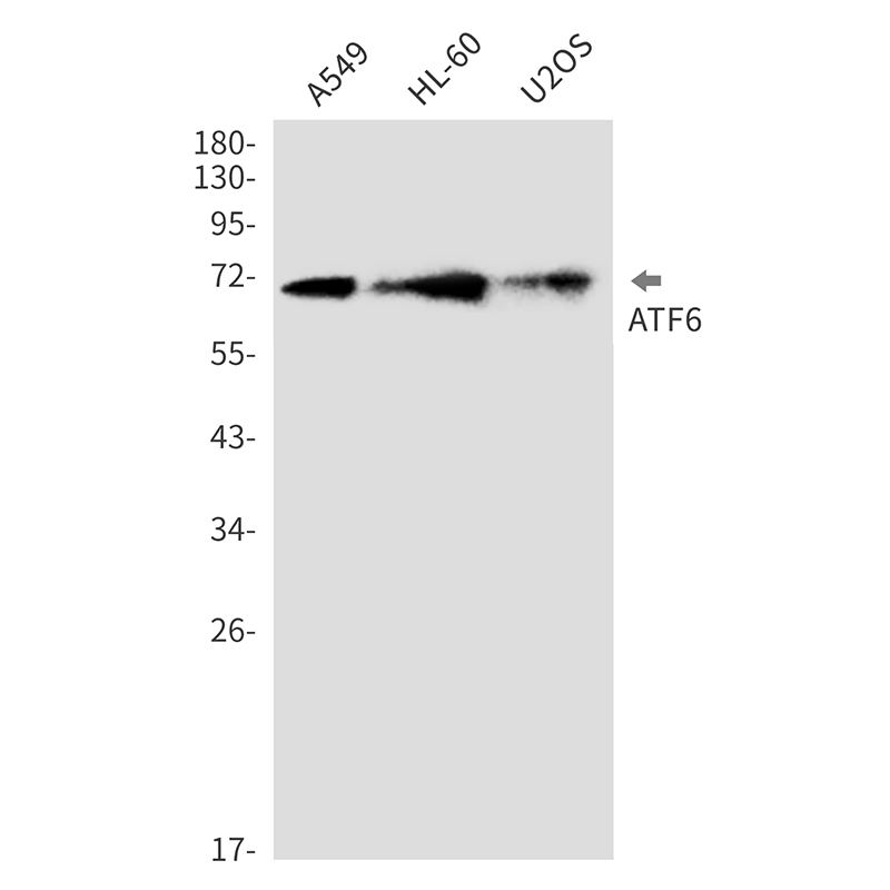 ATF6 Rabbit mAb ABZ3262