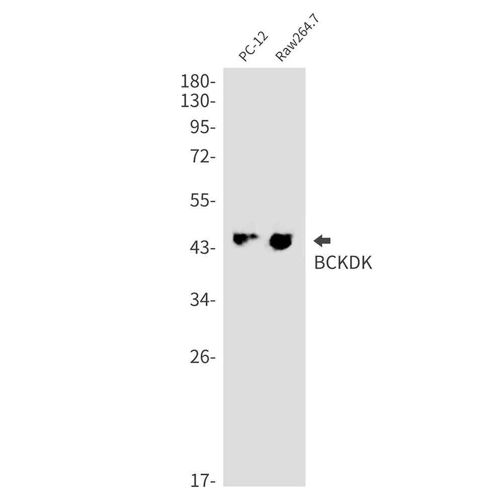 BCKDK Rabbit mAb ABZ3263